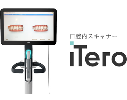 口腔内スキャナーiTero（アイテロ）とは？