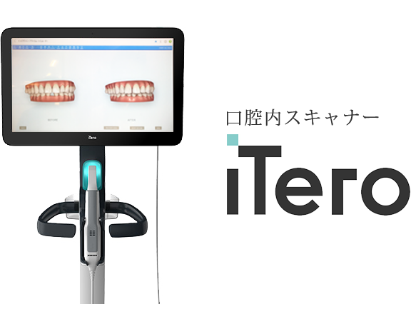 マウスピース矯正治療インビザライン